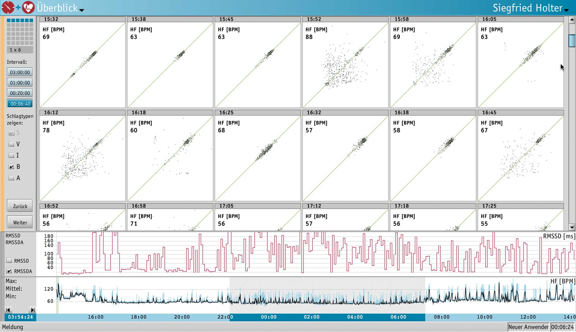 Medset Übersicht einer Langzeit-EKG-Auswertung
